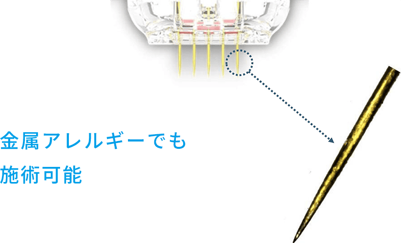 Sea Sail Beauty Clinic エリシスセンス 金メッキニードル